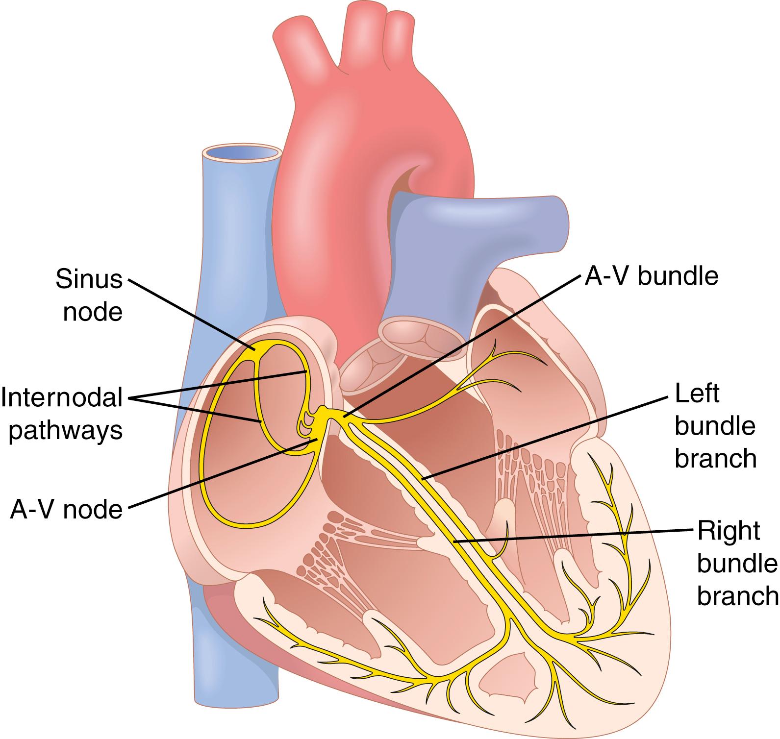 Figure 10-1, Sinus node and the Purkinje system of the heart, showing also the atrioventricular (A-V) node, atrial internodal pathways, and ventricular bundle branches.