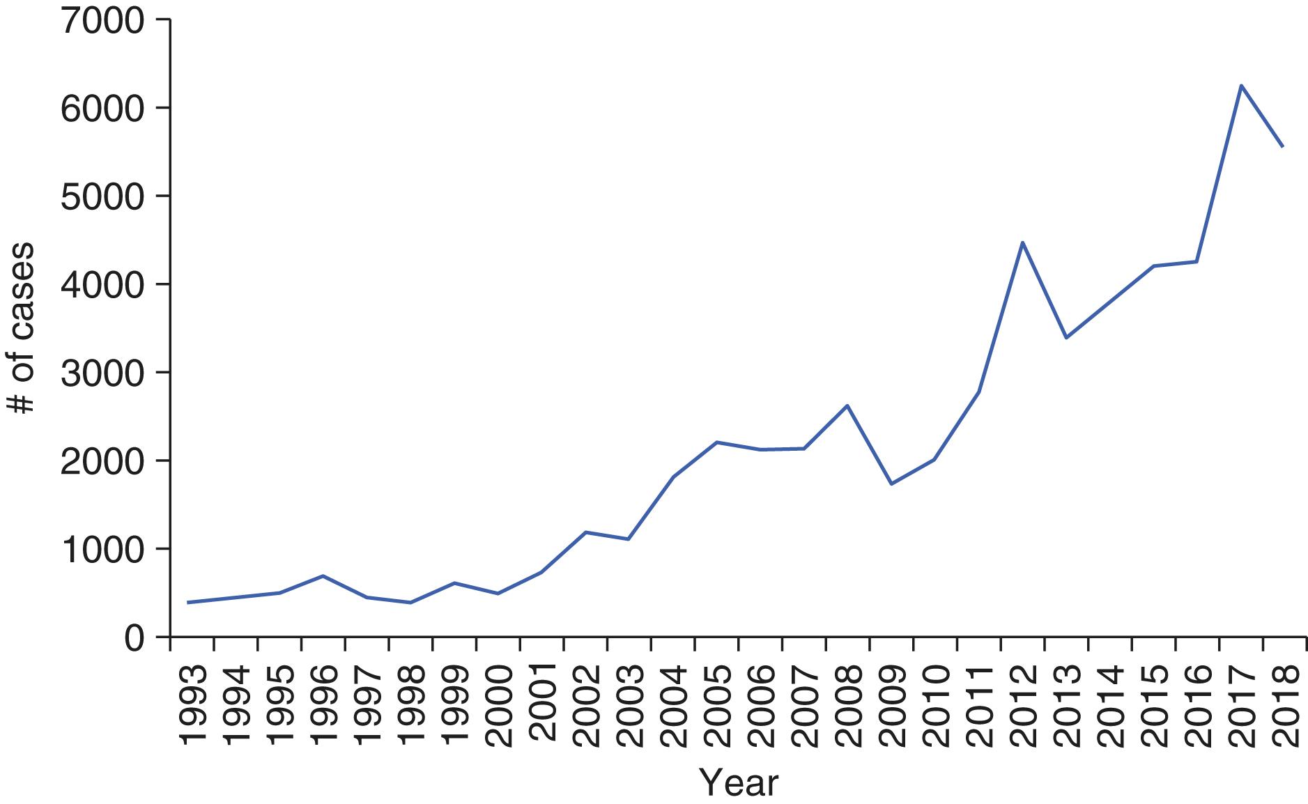 FIGURE 302-1, Number of reported cases of Rocky Mountain spotted fever in the United States, 1993 to 2018.