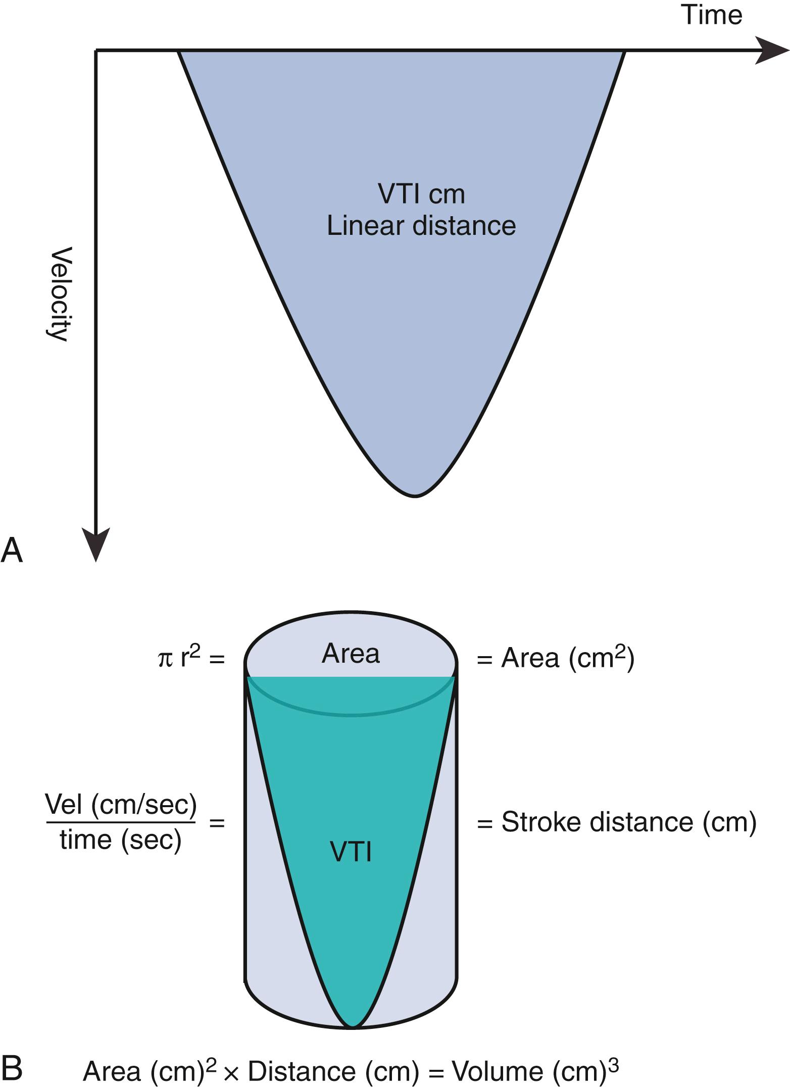 Figure 31.1, A, Schematic of a Doppler velocity profile with the integration of instantaneous velocities measured throughout the ejection period to derive the time velocity integral (TVI). B, Schematic of the stroke volume calculation. The volume of a cylinder is the product of its cross-sectional area and its length, in which length is the TVI (a linear distance).