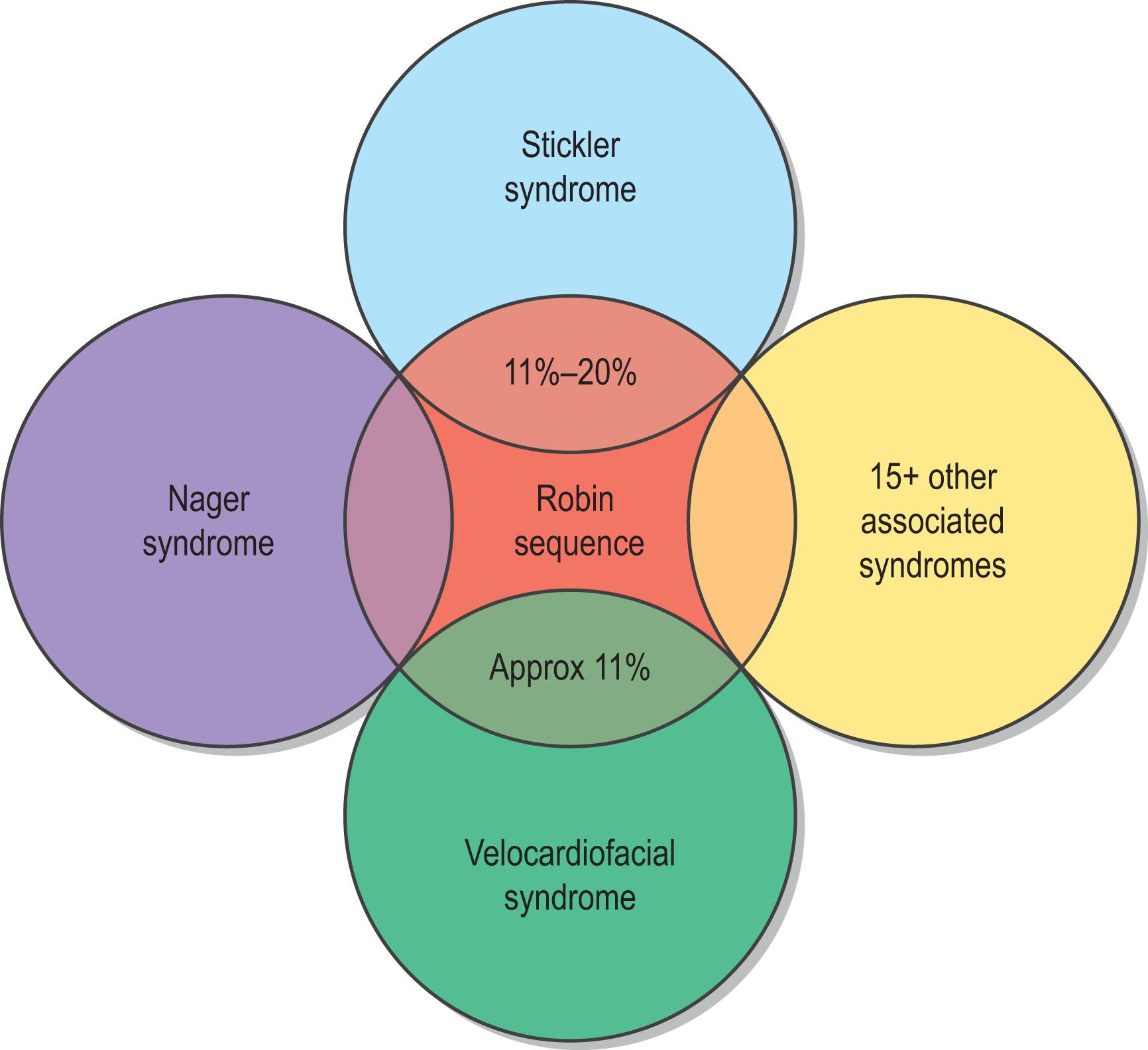 Figure 28.3, There are many syndromes associated with Robin sequence; however, it can be found in isolation as well.