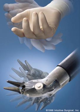 Figure 9.3, The robotic instruments are capable of “wristed motion,” which entails 7 degrees-of-freedom at the tips of the instruments, including flexion, extension, pronation, supination, radial and ulnar deviation, and grasping. This movement mimics those of the human hand and wrist.