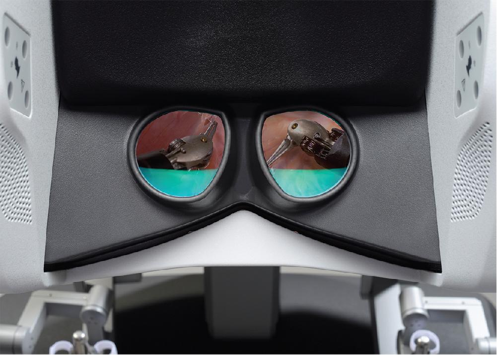 Fig. 3.3, Vision System.