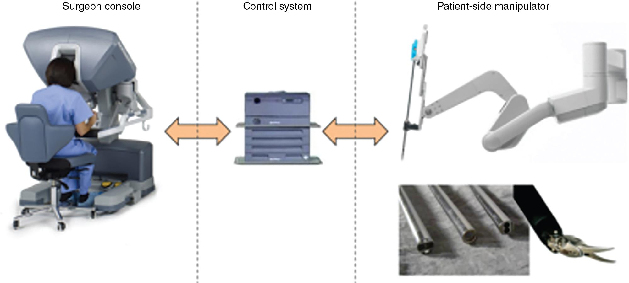 Fig. 25.1, The overall design of the da Vinci system, which is teleoperated controlled by the surgeon at the surgeon console. The console controls the robotic arms of the patient-side manipulator. Each patient-side manipulator contains a wristed instrument that can be interchanged for different tool tips.