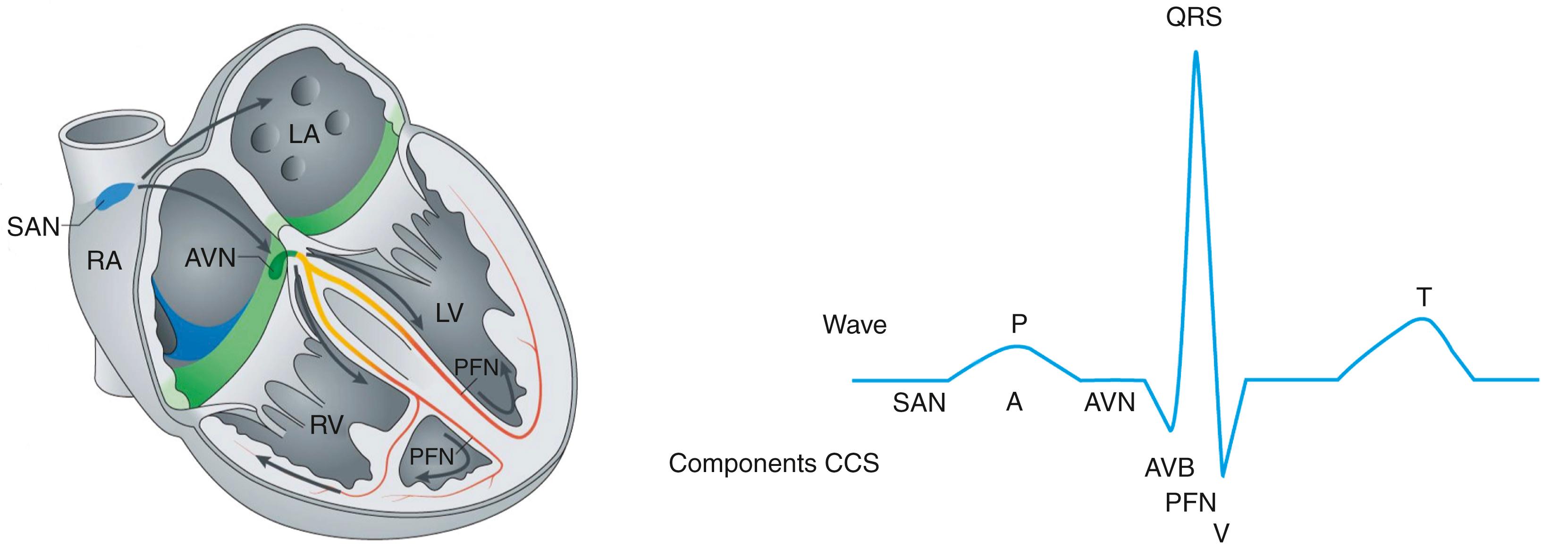 Fig. 12.1, Schematic of the components of the cardiac conduction system and surface electrocardiogram (ECG).