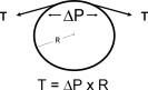 Figure. 86.2, Schematic and simplified representation of the wall tension, T, generated by the glomerular transcapillary pressure difference (ΔP) at the walls of a cylindrical capillary with radius R. According to Laplace’s law, T is directly proportional to both parameters.