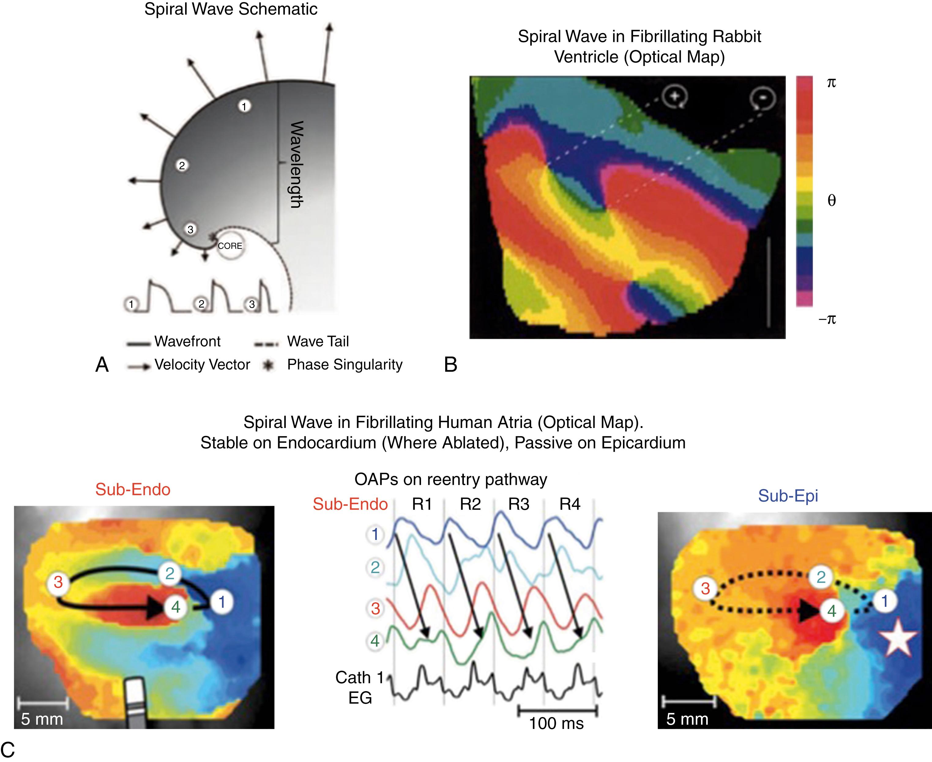 Fig. 43.3, Spiral wave reentry as drivers of cardiac fibrillation.