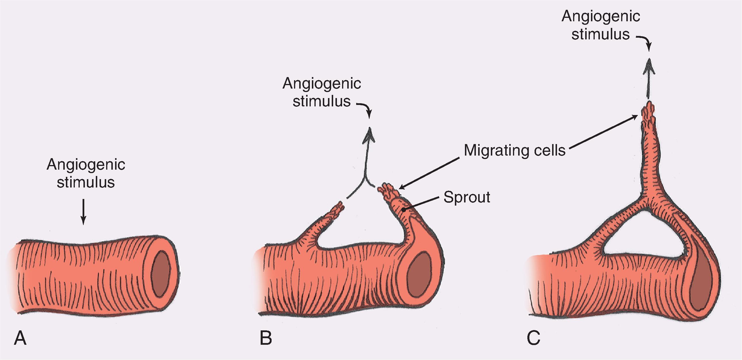 FIG. 2.6, Steps in angiogenesis. A , Initial stimulus with retraction of endothelial cells and thinning of basement membrane. B , Migration of endothelial cells and formation of capillary sprout. C , Formation of capillary loops, which become patent to form new blood vessels.