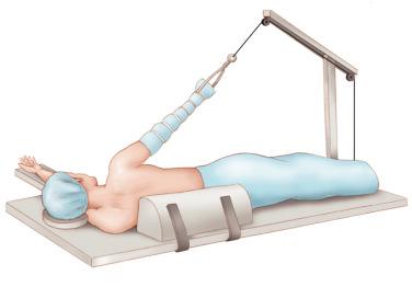 FIG. 44.5, Lateral decubitus positioning for shoulder arthroscopy.