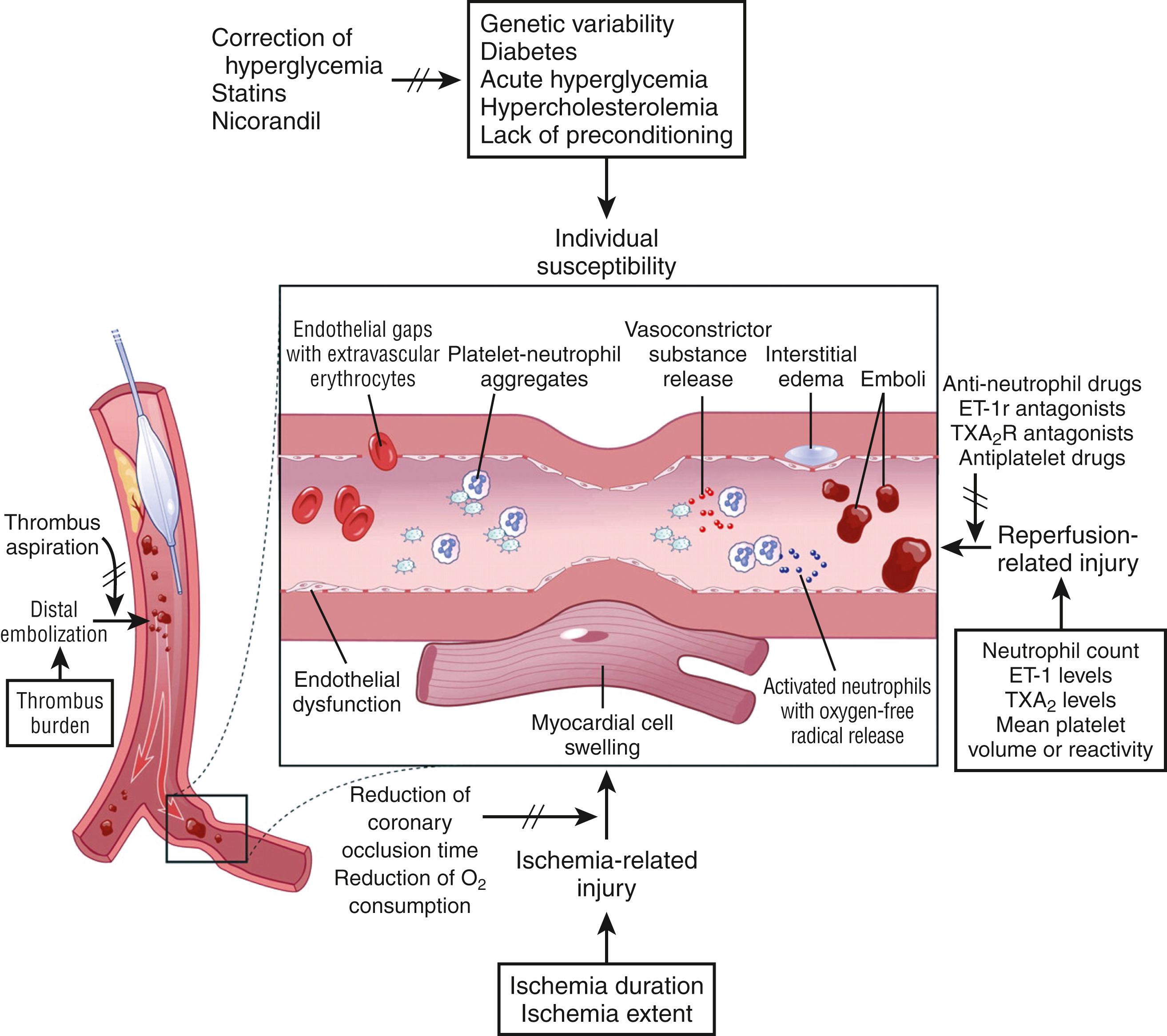 FIGURE 38.6, Multiple mechanisms involved in the pathogenesis of no-reflow that might be targeted by appropriate therapy. ET , Endothelin; TXA 2 , thromboxane A 2 .