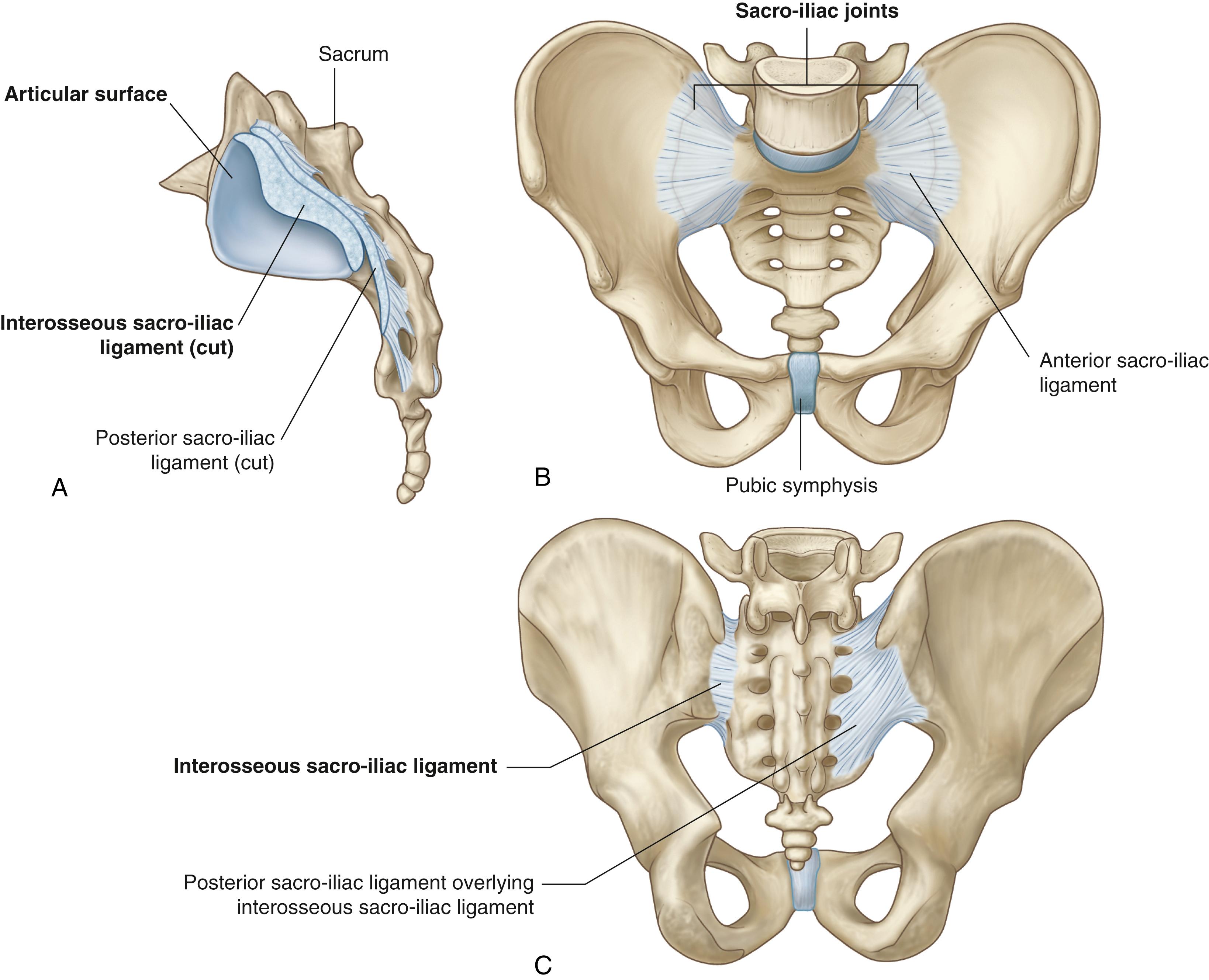 Fig. 140.1, Sacroiliac (SI) joint anatomy. A, SI joints have large, irregular articulating surfaces connecting S1‒S3 to the ilium. B, Anterior ligaments overlaying and stabilizing the SI joint surface. C, Strong posterior ligamentous stabilizing connections between the lumbosacral spine and the SI joint.