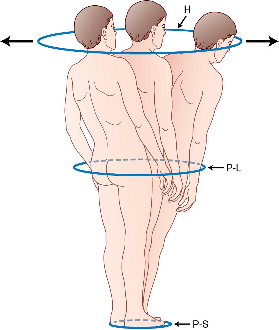 Fig. 52.1, Cone of economy. H, head; P-L, pelvic level; P-S, polygon of sustentation.