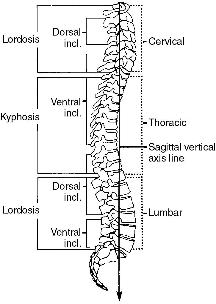 Fig. 52.2, Normal sagittal alignment of the spinal column. Note the sagittal vertical axis line and the orientation of each individual vertebrae.