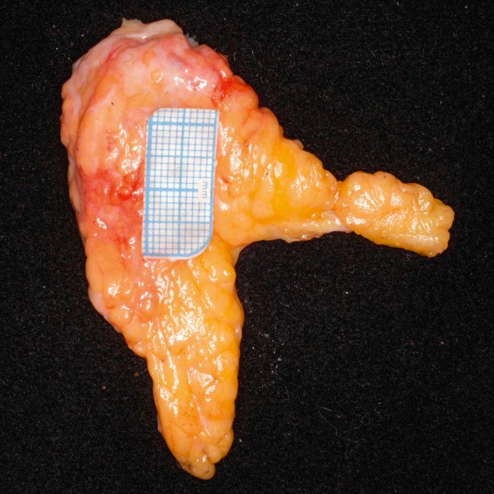 Fig. 1.1, The parotid gland has a lobular morphology.