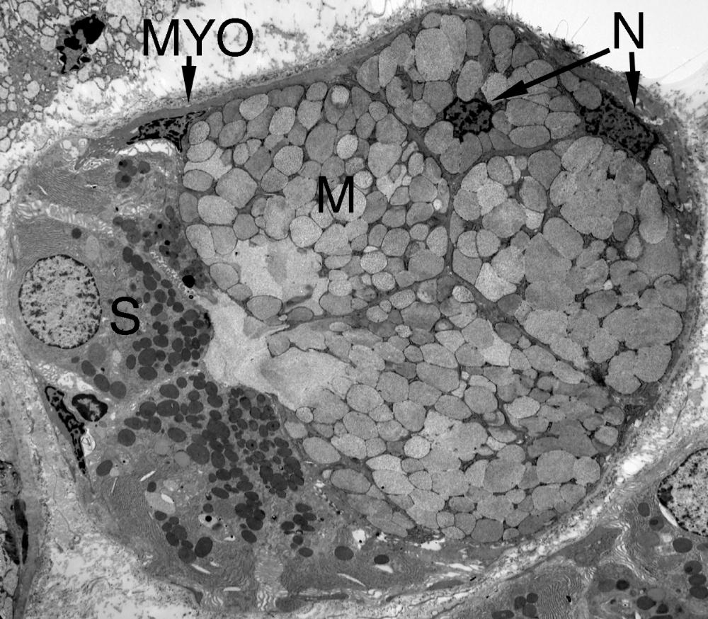 Fig. 5.5, Acinus of submandibular gland contains mucous cells (M) packed with large secretory granules and with two irregularly shaped nuclei (N). The serous cells (S) of the demilune contain darkly stained secretory granules and a rounded nucleus. A myoepithelial cell and process (MYO) are present. (Electronmicrograph, ×1450)