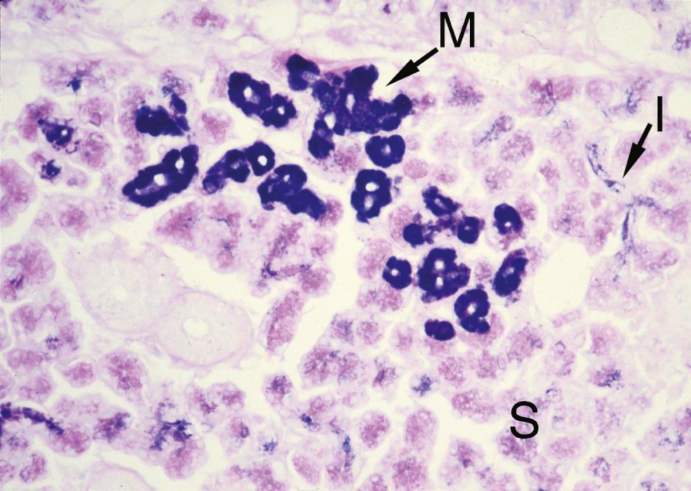 Fig. 5.6, Submandibular gland with acidic mucin in mucous cells (M) stained diffusely royal blue. Serous cells (S) and intercalated ductal cells (I) contain a granular mixture of neutral mucin stained red and acidic mucin stained royal blue. (Section stained with Alcian Blue at pH 2.5 followed by periodic-acid-Schiff [ABPAS], ×180)