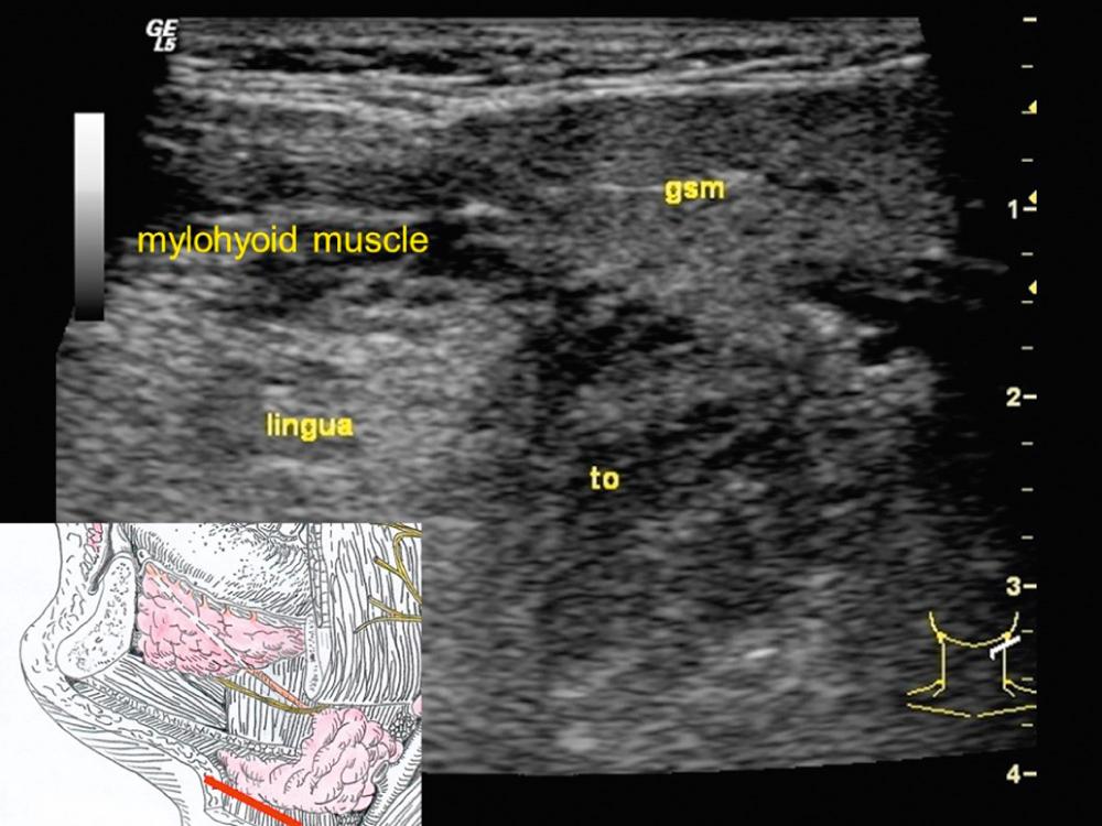 Fig. 3.2.3, The submandibular gland (gsm) can often be visualized together with the tongue (lingua) and pharyngeal tonsil (to).