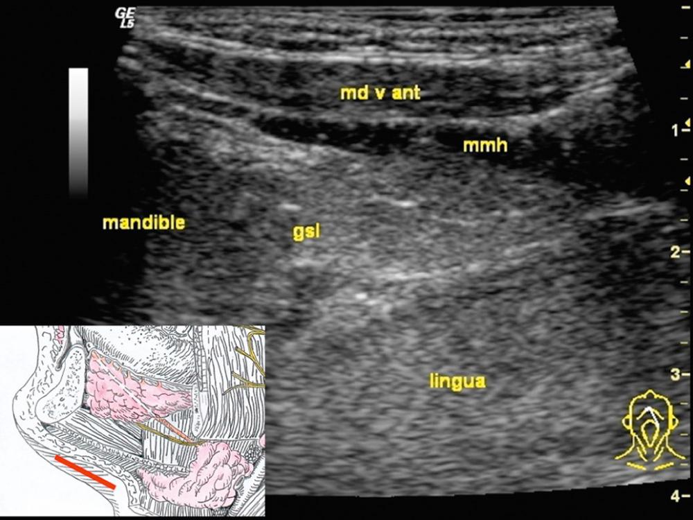 Fig. 3.2.5, The longitudinal view of the sublingual gland (gsl) shows its close relationship to the mandible, the tongue (lingua), and the mylohyoid muscle (mmh). md v ant, anterior belly of the digastric muscle.