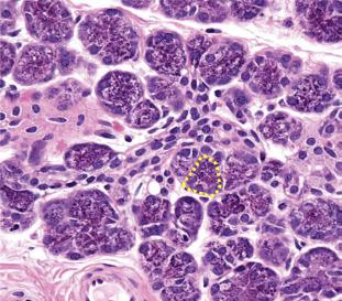 Fig. 37.3, Histomicrographs of the human parotid gland showing pyramidal acinar cells (outline) loaded with intensely eosinophilic zymogen granules.