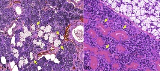 Fig. 37.4, Left : Submandibular gland tissue section showing mixed acinar populations (serous and mucous) as well as predominance of seromucinous acini (arrows) . Right : Male mouse submandibular salivary gland: the granular convoluted duct cells in the male mouse submandibular gland are large with prominent pink granular cytoplasm (arrows) .