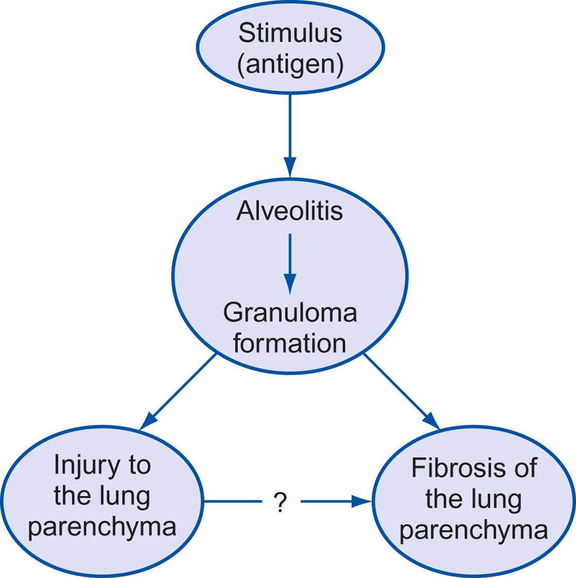 Figure 49-1, Postulated mechanisms of pulmonary damage in sarcoidosis.