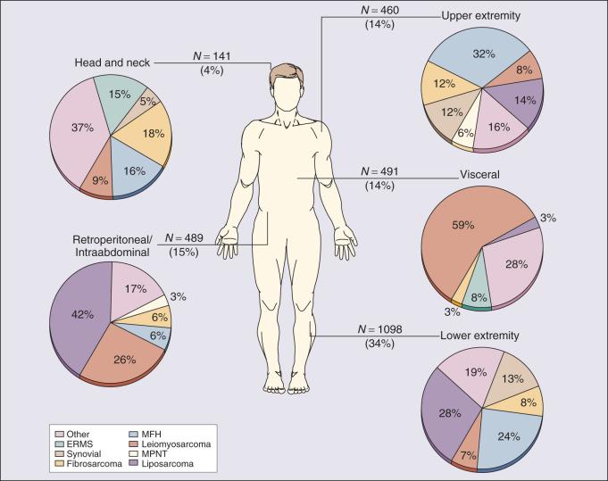 Figure 90.1, Anatomic distribution and site-specific histologic types in 4207 adult patients with soft tissue sarcomas seen at the University of Texas MD Anderson Cancer Center, 1996–2003. ERMS, embryonal rhabdomyosarcoma; MFH, malignant fibrous histiocytoma; MPNT, malignant peripheral nerve sheath tumor; UPS, malignant fibrous histiocytoma.