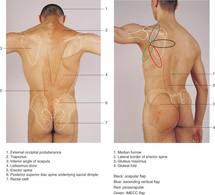 Figure 40.4, Anatomic landmarks and markings.