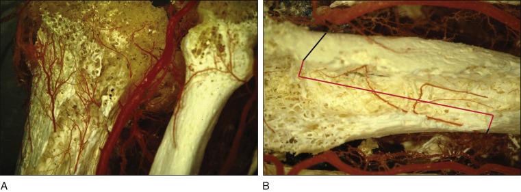 FIG. 2.2