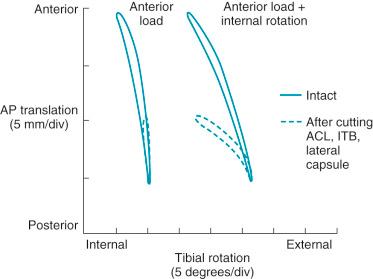 FIG 3-9, Anterior translation versus tibial rotation is shown during the Lachman-type anterior loading test at 15 degrees of knee flexion. The amount of anterior tibial translation is shown vertically and the position of tibial rotation is shown horizontally. ACL, Anterior cruciate ligament; AP, anteroposterior; div, division; ITB, iliotibial band.