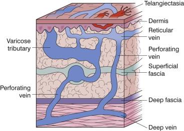 FIGURE 36.2, Cutaneous venous system. The interconnections between the deep and superficial venous systems in the skin.