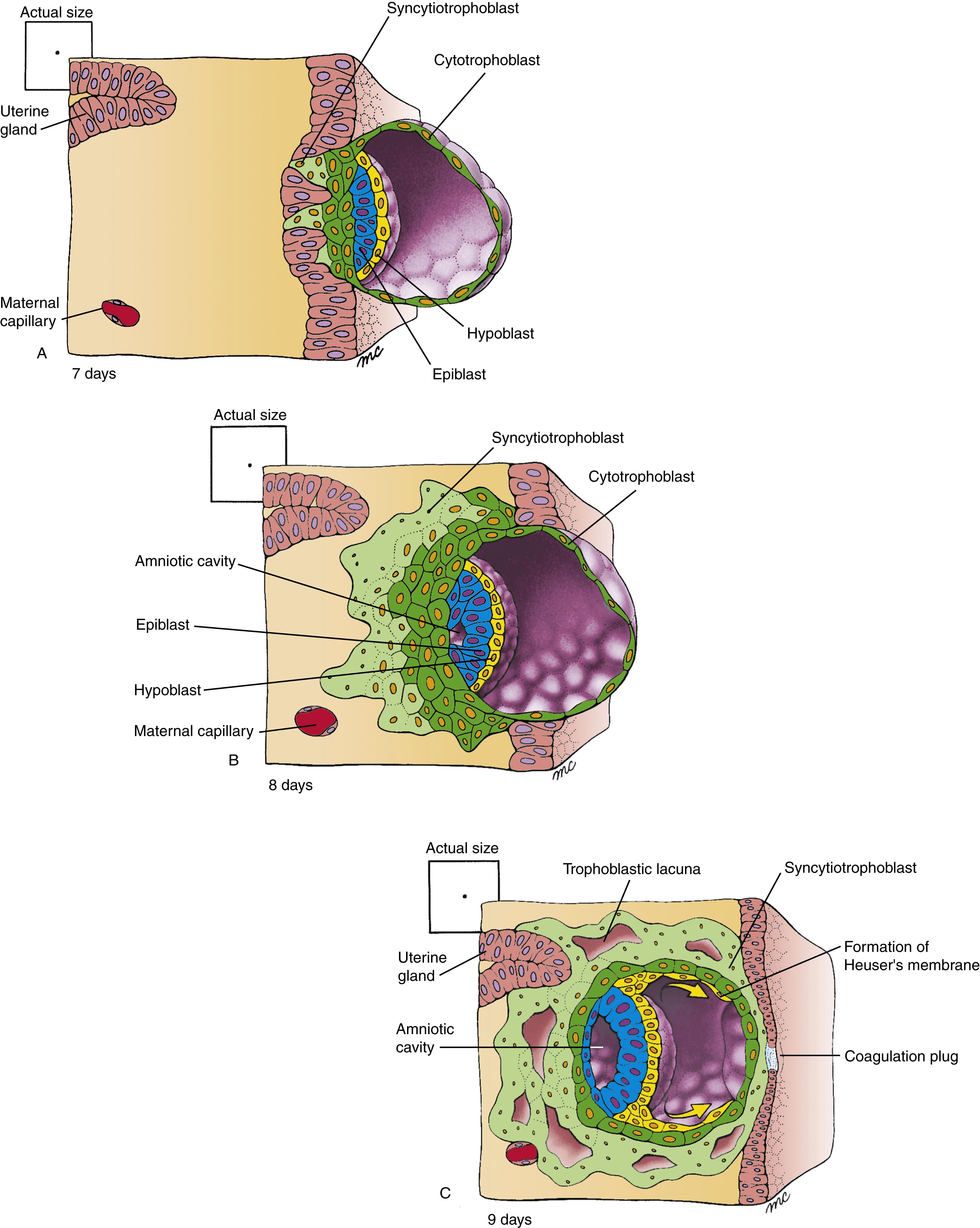 Fig. 2.1, Initial Stages of Implantation