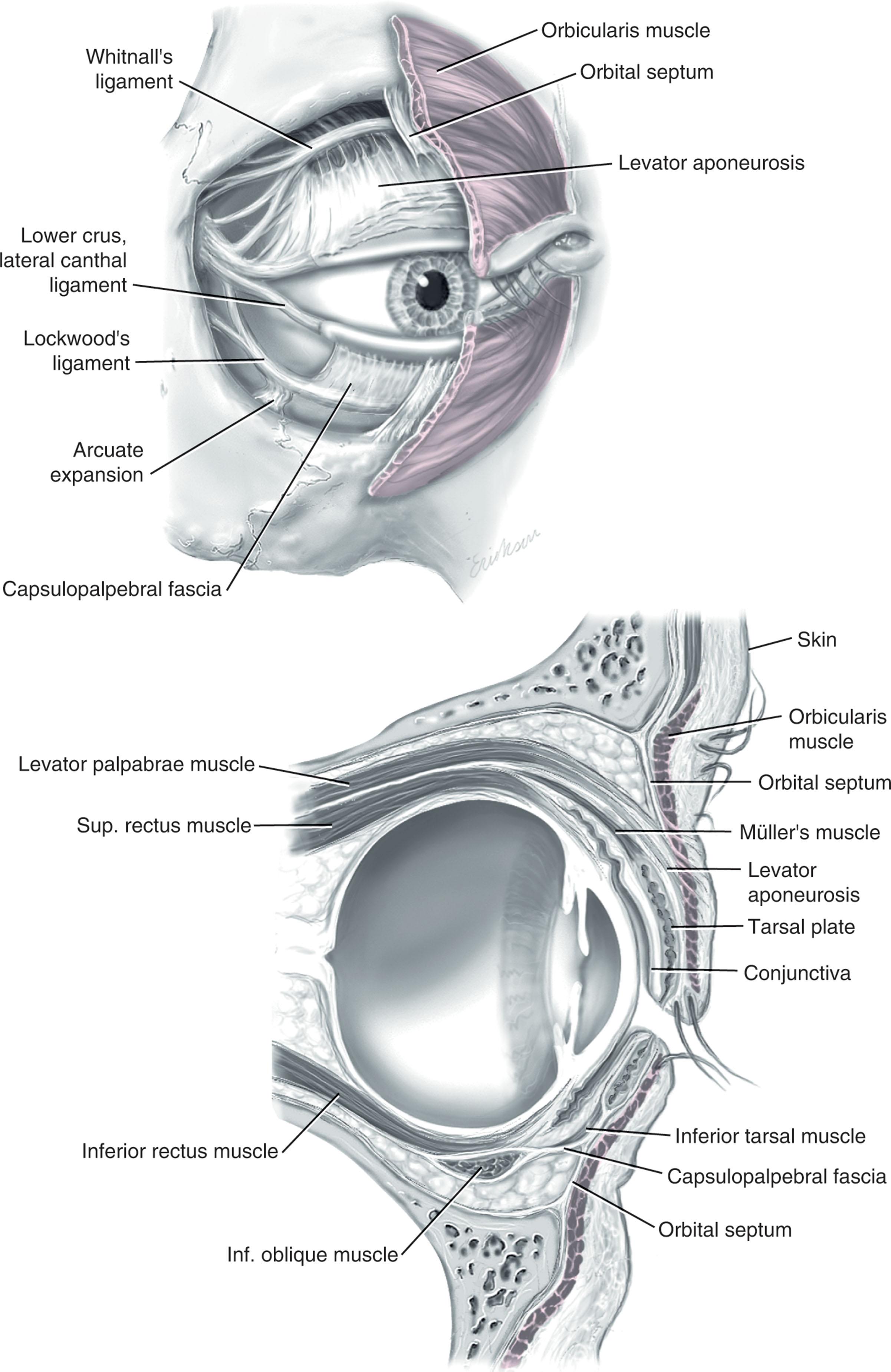 Figure 14.2, The orbicularis oculi muscle is a broad muscular sphincter of the eyelid. It is adherent to the overlying eyelid skin. Crucial anchors for the muscle include the frontal bone, medial canthal tendon and inferior orbital medially as well as the lateral canthus laterally. Sup., superior; Inf., inferior.