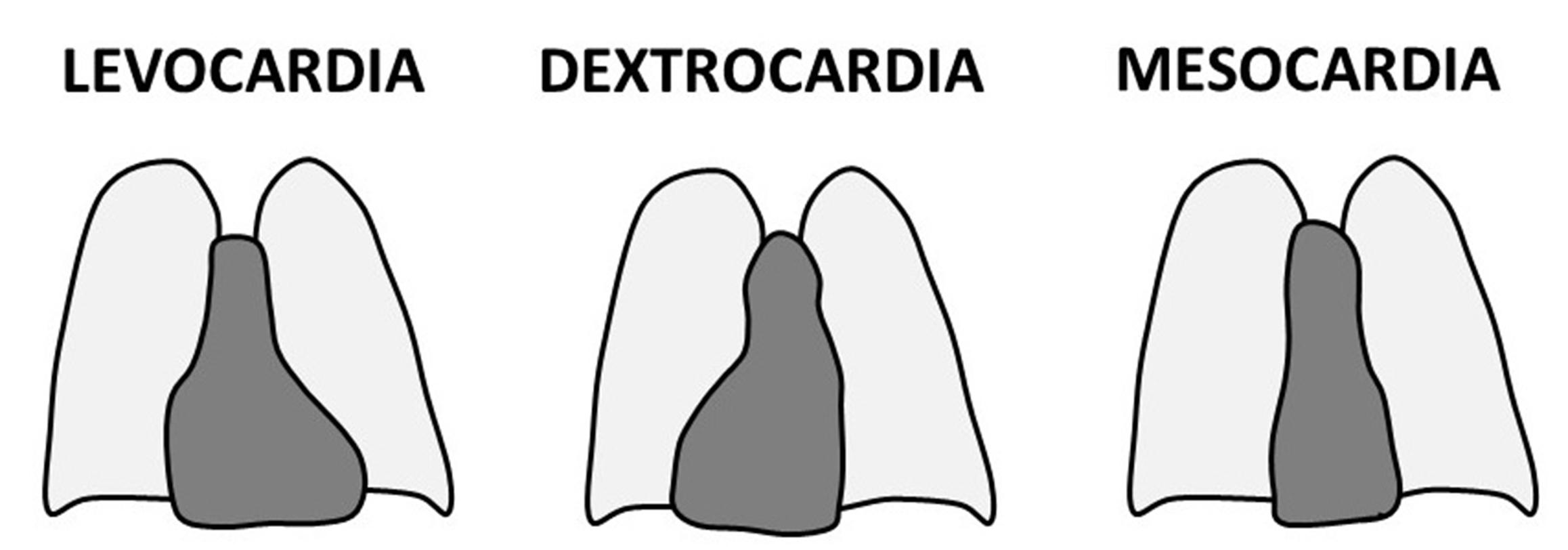 Figure 1, Cardiac positions.
