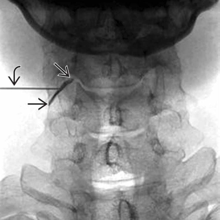 C6 Selective Root Block