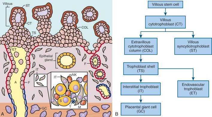 • eFig. 6.1, Schematic representation of the implantation site. A, Placental villi (top) are shown with anchoring cytotrophoblast cell columns and trophoblast invasion into the maternal decidua (bottom) . Maternal blood from decidual spiral arteries (A) fills the intervillous space in direct contact with syncytiotrophoblast (ST). Distinct trophoblast populations are shown. Villous trophoblast comprises: cytotrophoblast (CT) which forms the inner layer and is proliferative. CT fuse to form the outer syncytiotrophoblast layer (ST) which is in contact with maternal blood. Neither CT or ST stain for HLA-G. Extravillous trophoblast includes cytotrophoblast cell columns (COL), interstitial trophoblast (IT), endovascular trophoblast (ET) and placental bed giant cells (GCs); all stain strongly for HLA-G. Anchoring cell columns coalesce to form a continuous trophoblast shell (TS). From this shell, interstitial trophoblasts (ITs) invade through the decidual stroma to encircle and destroy the arterial media, which is replaced by fibrinoid material (F). ETs move in retrograde fashion down spiral arteries, displacing endothelial cells. On reaching the inner layer of the myometrium, trophoblast cells differentiate to multinuclear giant cells (GCs). The inset shows a representation of cellular interactions within the decidua. ITs are seen between large decidual stromal cells (S). Maternal leukocytes present are mainly uterine natural killer (uNK) cells with a few macrophages (Ms) and occasional T cells (Ts).