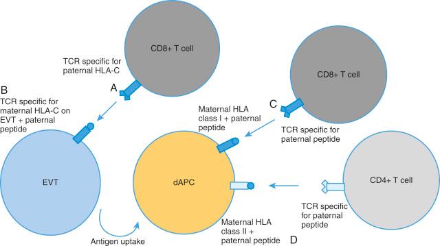 • eFig. 6.2, Potential interactions between maternal T cells and extravillous trophoblast cells (EVTs) depends on their major histocompatibility (MHC) restriction and antigen specificity. A, CD8+ effector T cells may directly recognise paternal HLA-C, regardless of the antigen bound, if the paternal human leukocyte antigen (HLA)-C molecule structure is sufficiently different. B, CD8+ effector T cells may directly recognise maternal HLA-C on EVT presenting a paternal antigen. C, CD8+ T cells could indirectly recognise paternal antigen presented on maternal MHC class I on decidual antigen-presenting cells (dAPCs). This would rely on the process of cross-presentation. D, CD4+ effector T cells can indirectly recognise paternal antigen presented on maternal MHC class II on dAPCs. (Figure based on an idea by Emma Charlton.)
