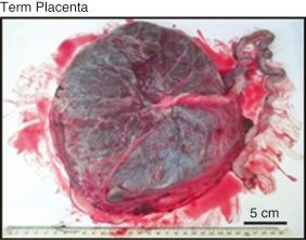 • eFig. 7.1, From Warrander LK, Batra G, Bernatavicius G, et al. Maternal perception of reduced fetal movements is associated with altered placental structure and function. PLoS One 7(4):1, 2012.