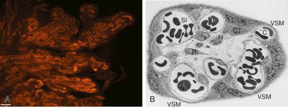 • eFig. 7.4, A, Fetal capillaries coiling inside the terminal villi, stained for endothelial cell marker PECAM-1 and B, demonstrates these features, with sinusoidal dilated capillaries that protrude to the surface of the syncytiotrophoblast forming the VSM.