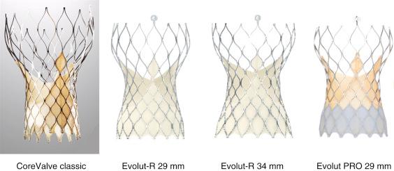 Fig. 54.1, The CoreValve family of self-expanding bioprosthetic designs.