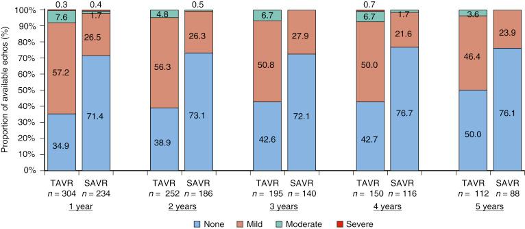 Fig. 54.8, Occurrence of aortic regurgitation through 5 years after transcatheter aortic valve replacement (TAVR) and surgical aortic valve replacement (SAVR) . Total aortic regurgitation reported by the investigational sites through 5 years for patients in the TAVR and SAVR groups.