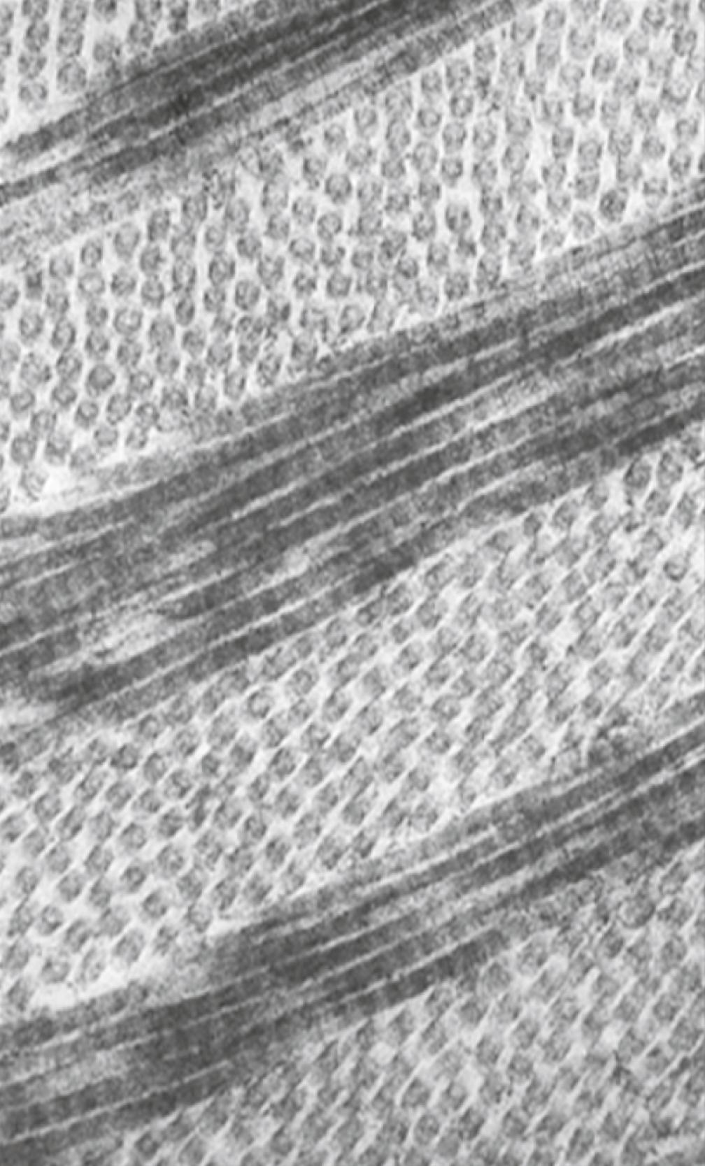 Fig. 13.12, Electron micrograph of corneal collagen showing the orthogonal arrangement of the collagen fibers.