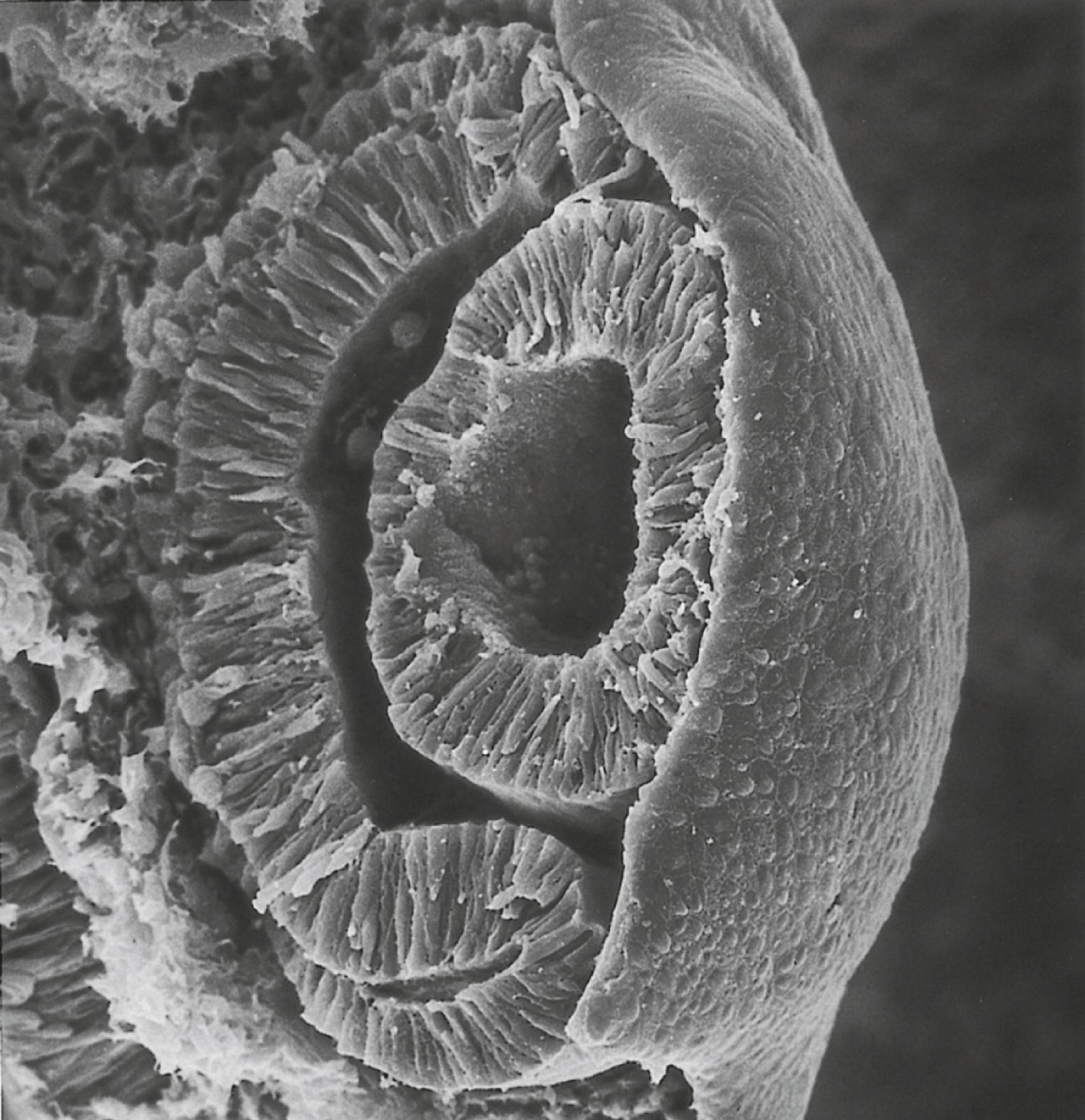 Fig. 13.5, Scanning electron micrograph of the optic cup (left) and lens vesicle (center) in the chick embryo.