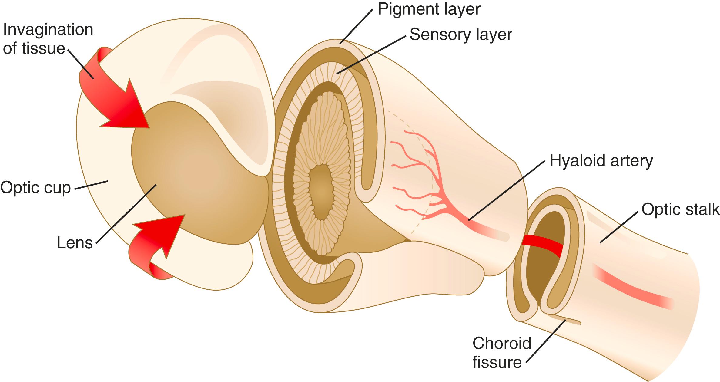 Fig. 13.6, Optic cup and stalk showing the choroid fissure containing the hyaloid artery.