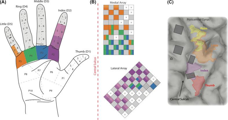 Figure 131.3, Locations for tactile sensations perceived during brain microstimulation in a quadriplegic study participant. (A) Hand/finger locations for percepts; (B) orientation of microelectrode arrays with respect to the central sulcus and mapping to hand/finger percept locations; and (C) location of microelectrode arrays in the brain.