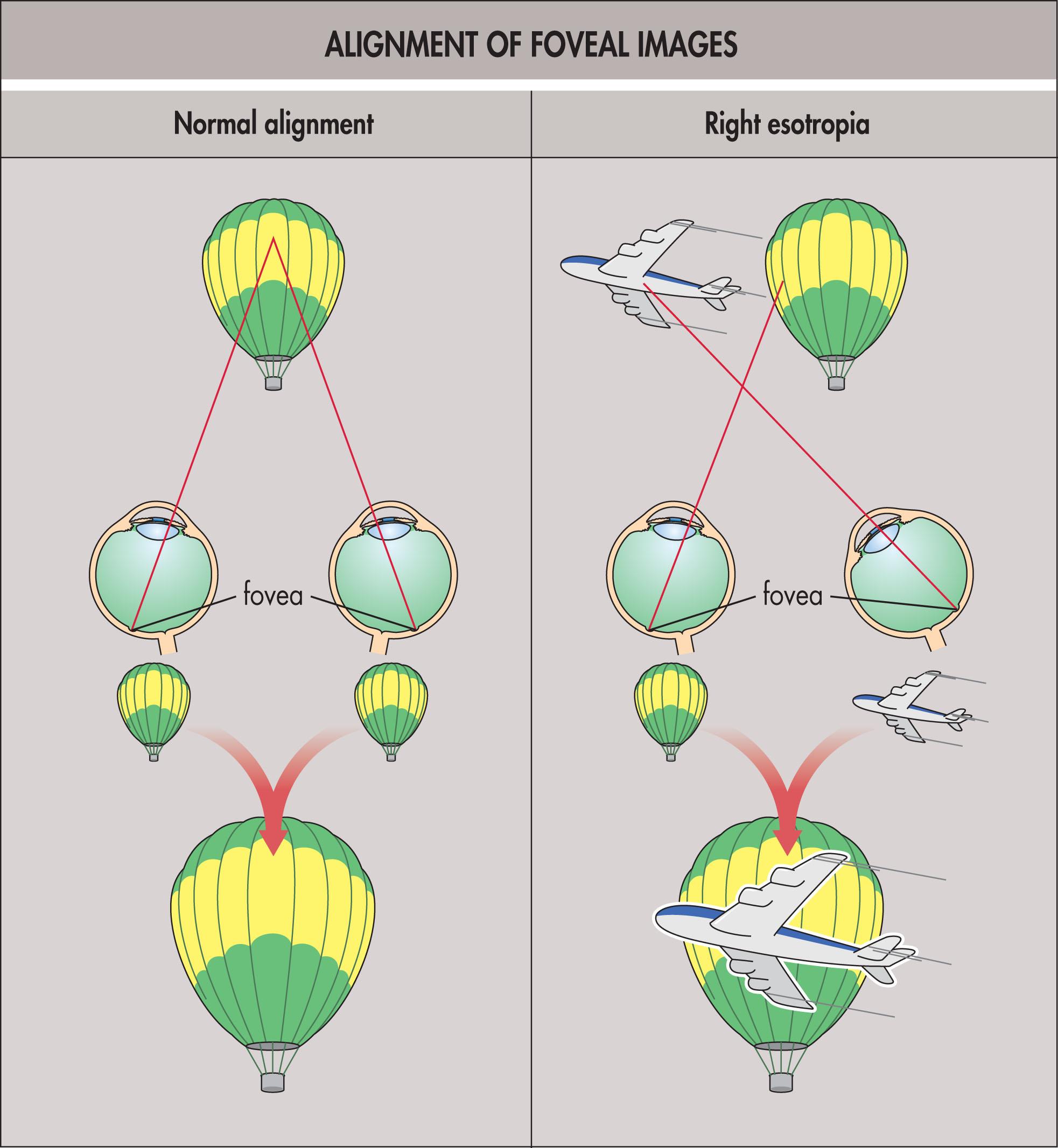 Fig. 11.5.1, Alignment of Foveal Images.