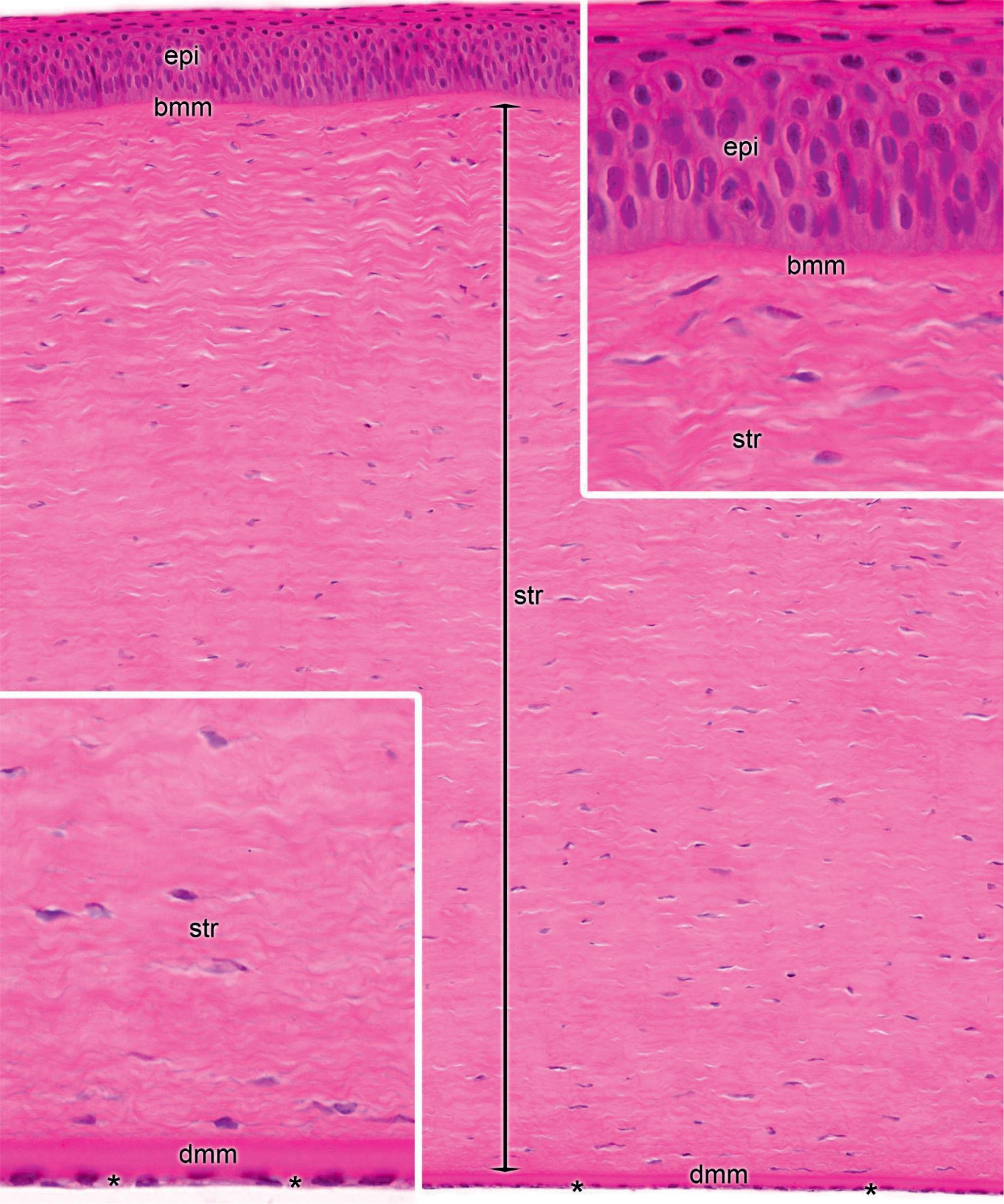 Figure 320, Cornea. The cornea is composed of a corneal stroma (str) covered externally by the corneal epithelium (epi) and the underlying basement membrane called Bowman’s membrane (bmm, upper inset). Corneal epithelium (epi) is continuous with the epithelium of the conjunctiva and it is composed of thin (approximately five cell layers thick) stratified squamous epithelium without penetrating papillae (upper inset). Internally, the stroma is lined with simple squamous epithelium (asterisks, lower inset) that rests on the basement membrane facing the stroma (Descemet’s membrane, dmm). The stroma of the cornea (str) is avascular and it is composed of several layers of regularly arranged collagen fibrils and fibroblasts.