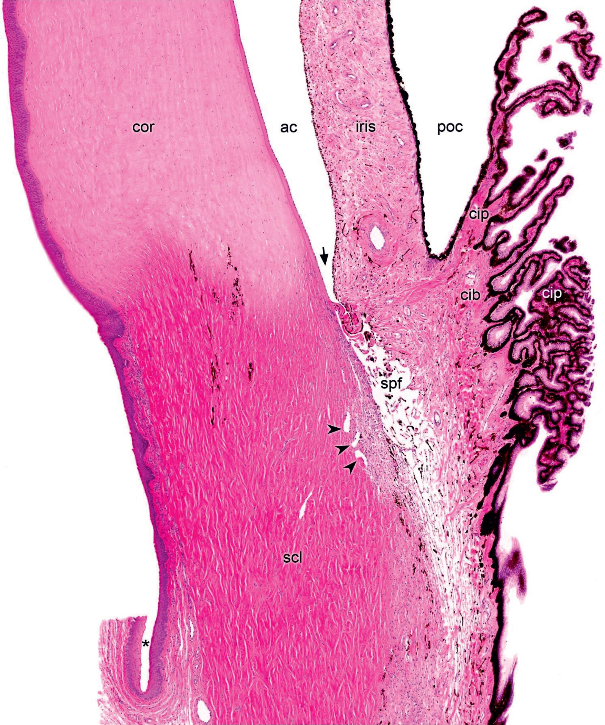 Figure 321, Iridocorneal angle, small magnification. The anterior, translucent cornea (cor) continues into the posterior, nontransparent sclera (scl) covered anteriorly with the bulbar conjunctiva that transitions into the palpebral conjunctiva at the conjunctival fornix (asterisk) covered with stratified columnar epithelium with goblet cells. The choroid continues anteriorly into the ciliary body (cib) with the ciliary processes (cip) and then into the iris. Aqueous humor is reabsorbed at the iridocorneal angle (arrow) through the vascular spaces of Fontana (spf) that lead into the canal(s) of Schlemm (arrowheads) running circularly at the iridocorneal angle. Between the cornea and the iris, the anterior chamber (ac) communicates with the posterior chamber (poc) through the pupil.