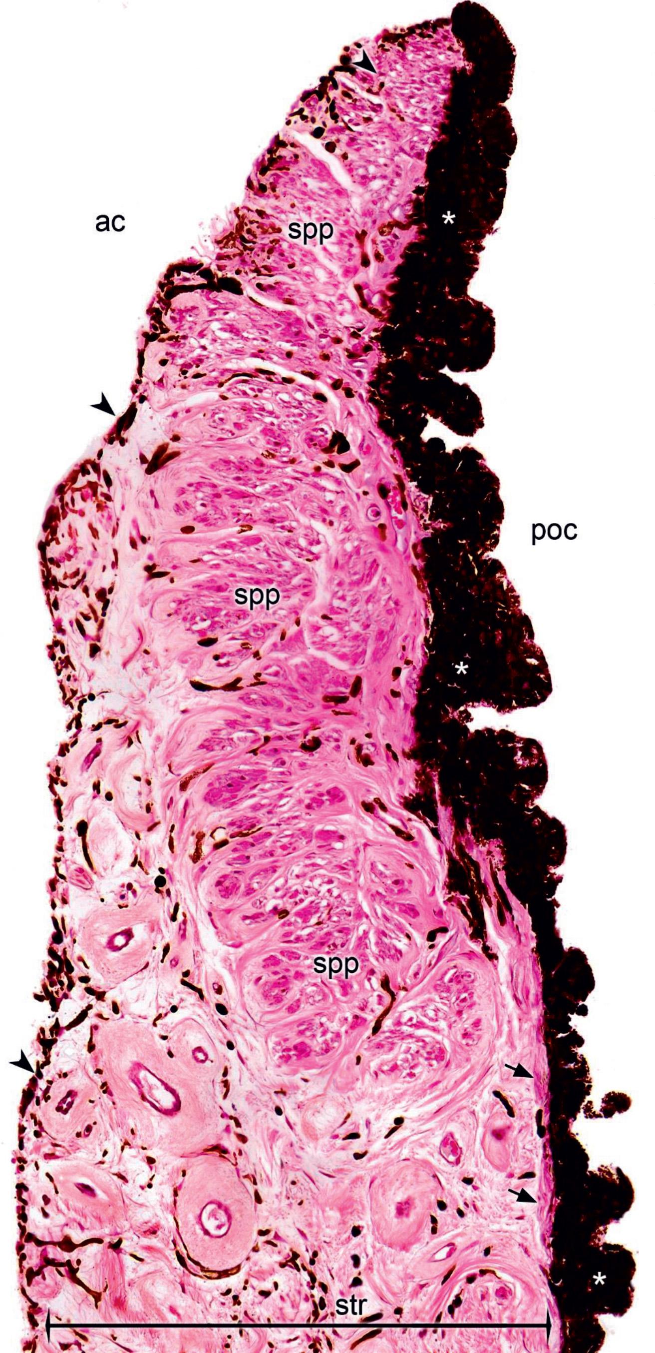 Figure 324, Iris, pupillary margin. Iris is composed of vascularized stroma (str) formed by fibroblast and melanocytes with deep spaces between the interconnecting bundles. At the pupillary margin, stroma contains circularly arranged smooth muscle cells forming the sphincter pupillae muscle (spp) that is under parasympathetic control. Facing the posterior chamber (poc), the stroma of the iris is covered posteriorly by myoepithelial cells forming the dilator pupillae muscle (arrows) and a layer of extremely pigmented epithelial cells (five-pointed asterisks) that also line the ciliary processes. Anteriorly, facing the anterior chamber (ac), iris is lined with a discontinuous layer of scattered melanocytes (arrowheads) and fibroblasts.