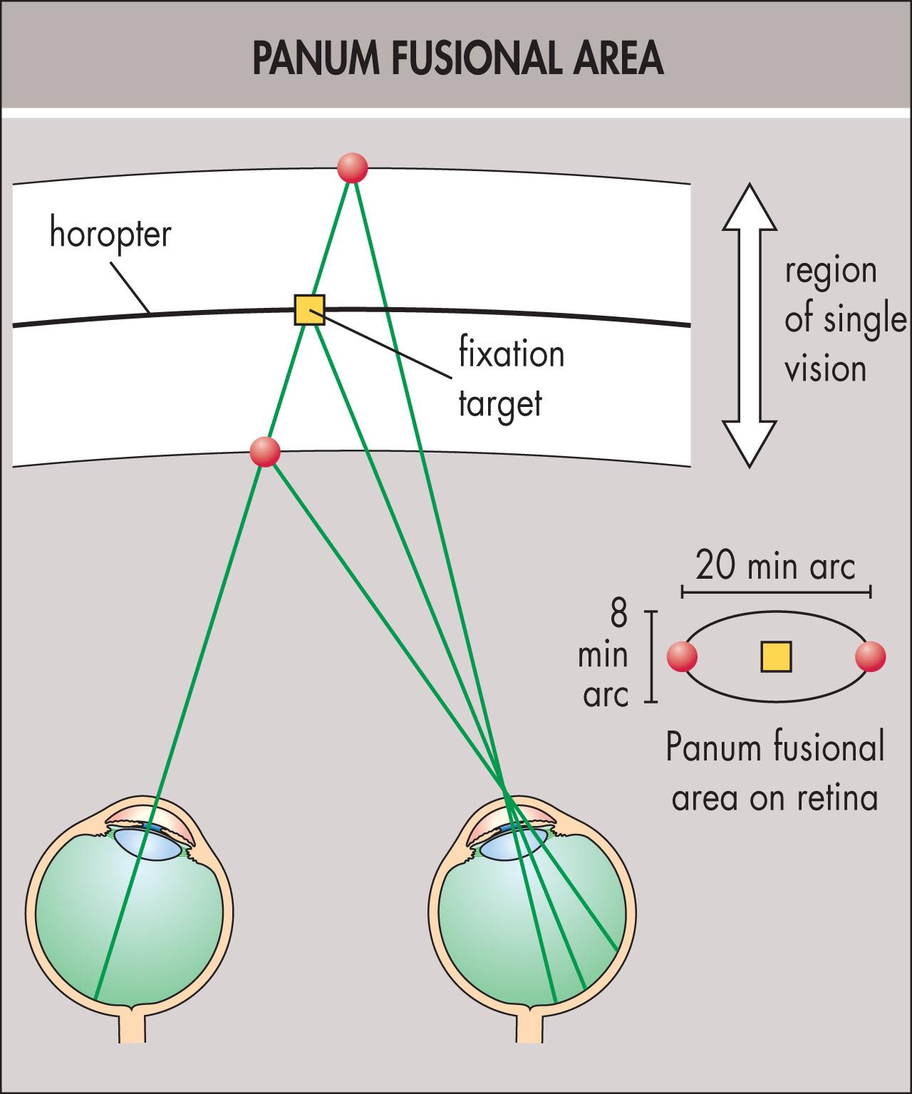 Fig. 11.4.1, The Horopter and Panum's Fusional Area.