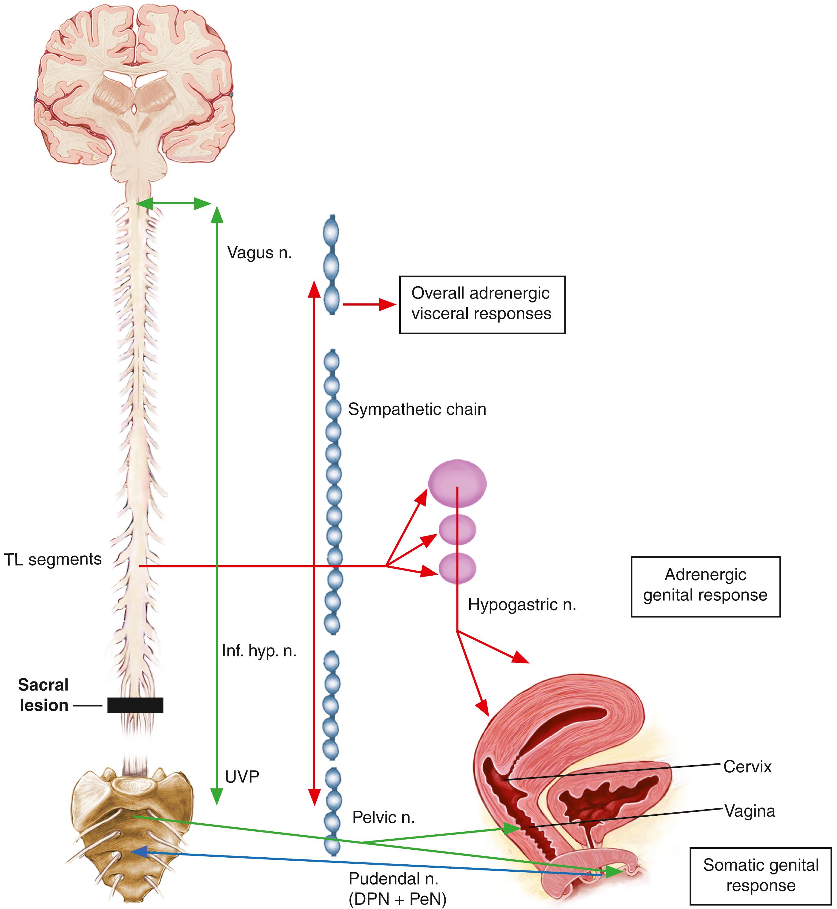 Fig. 46.8, Sexual Function Following Lower (Sacral) Lesions in Females.