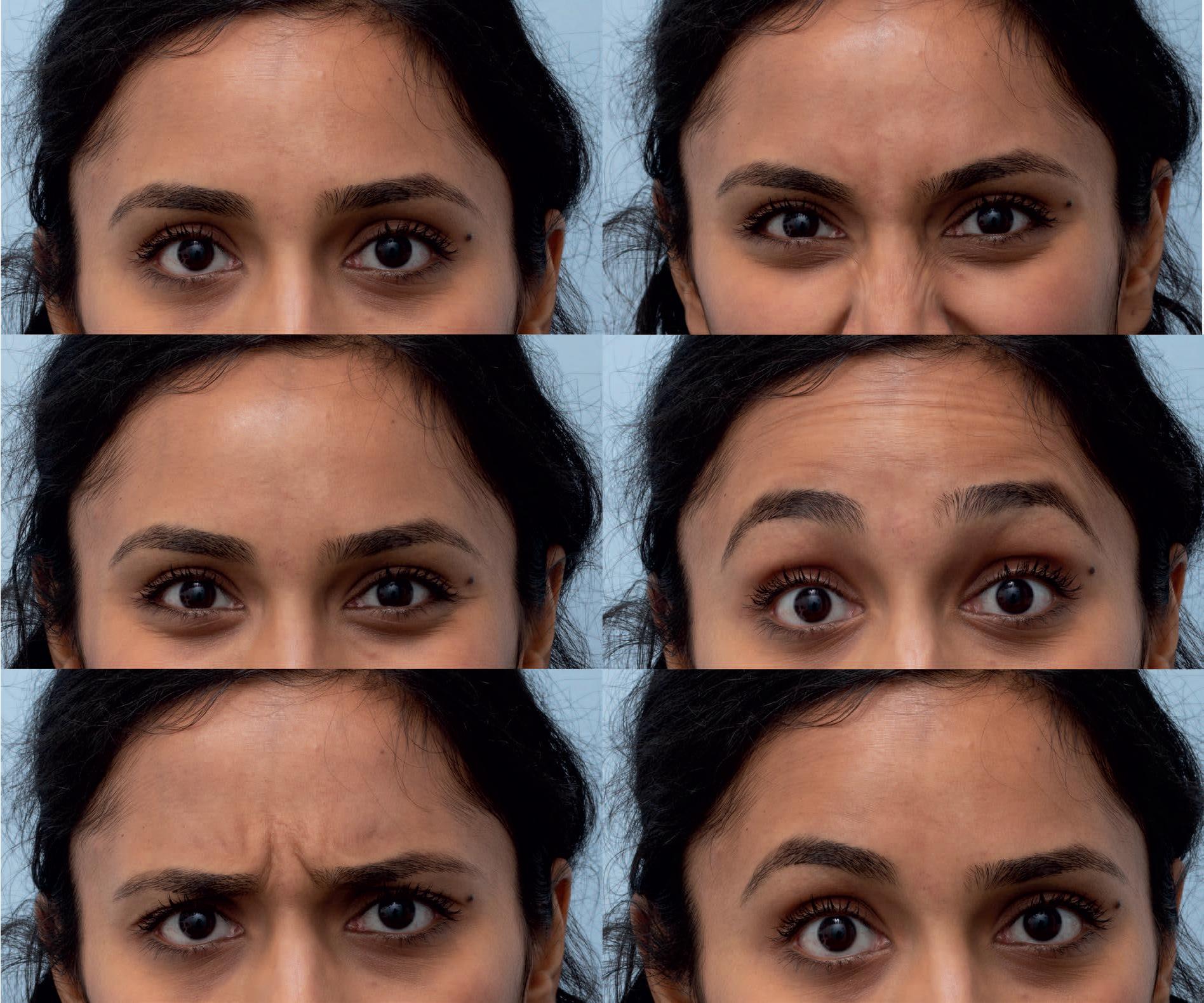 Fig. 17.1, Nonverbal expressions of neutral interest, anger, happiness, surprise, fear and uncertainty or disbelief, illustrated by changes in brow and surrounding musculature.